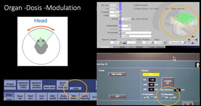 Abb.4: Dosismodulation deaktivieren bei Canon CT