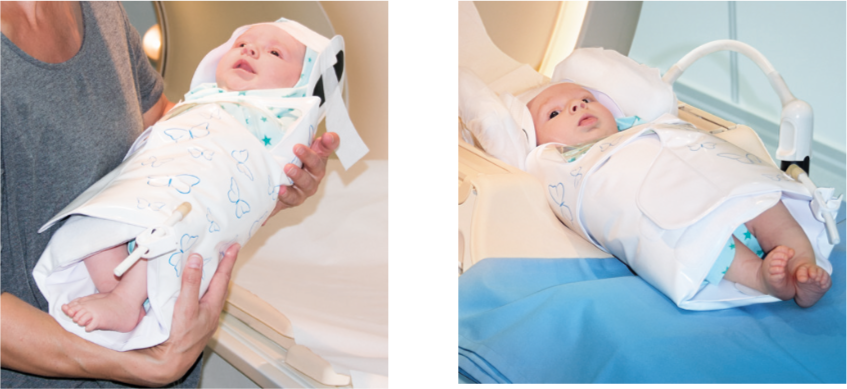 Abb. 5 und 6: Stillen oder Schoppengabe durch Mutter. Danach Neugeborenes in der MRT Spule platzieren.