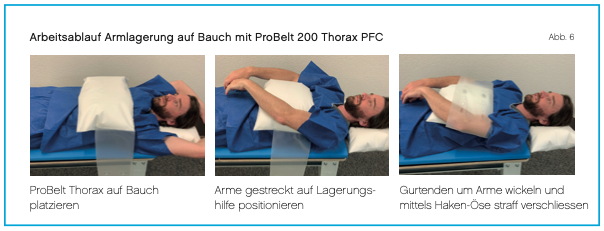 Lagerung Arme-auf-Bauch mit ProBelt Thorax PFC