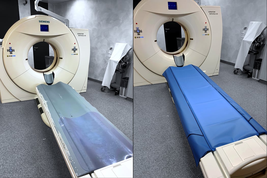 CTTC_Before vs After Siemens