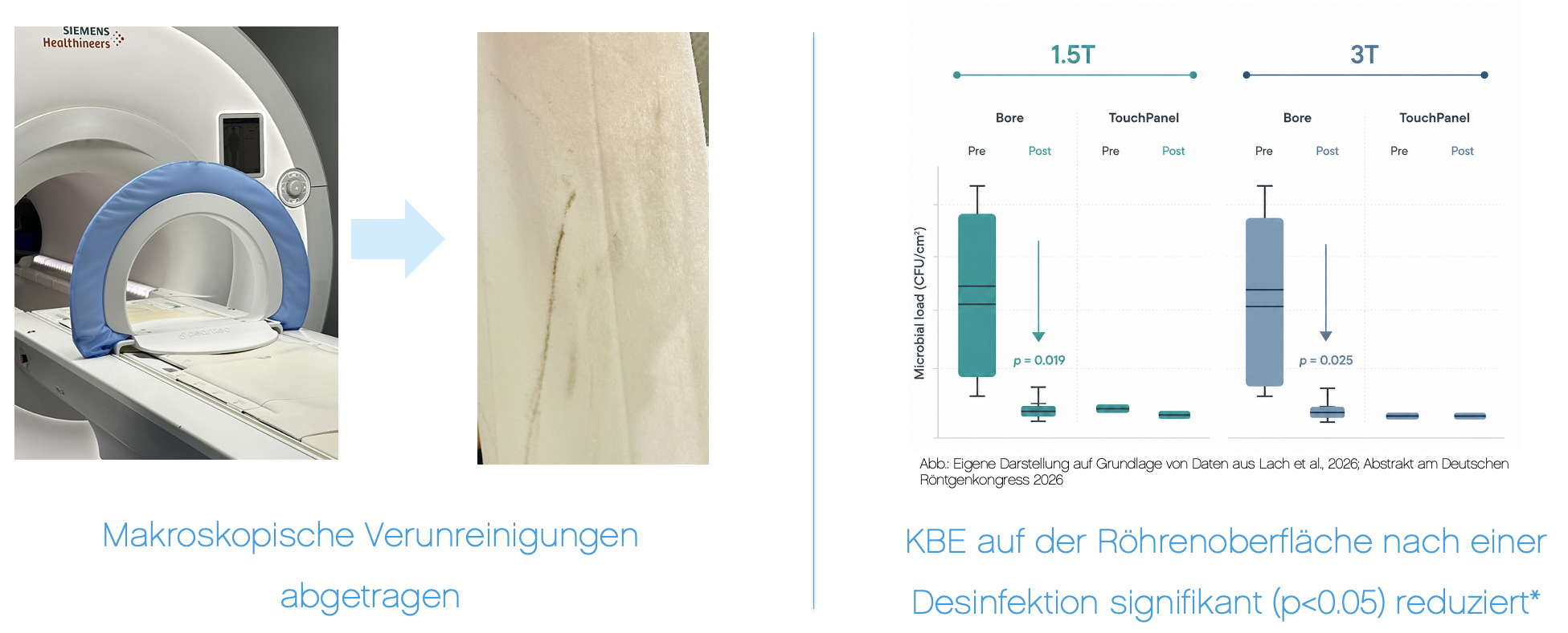 Effektive_Reinigung_MRT_Uebersicht