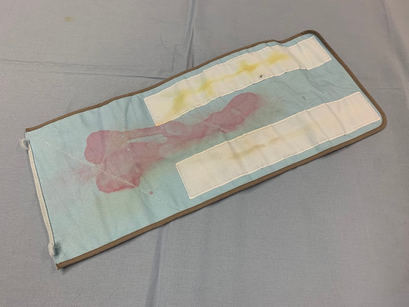 Negative Example ProBelt