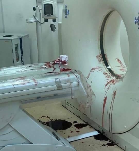 Negative Example bloody CT gantry CTGC