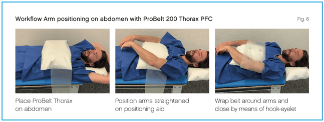 Arms-on-Abdomen Application ProBelt Thorax