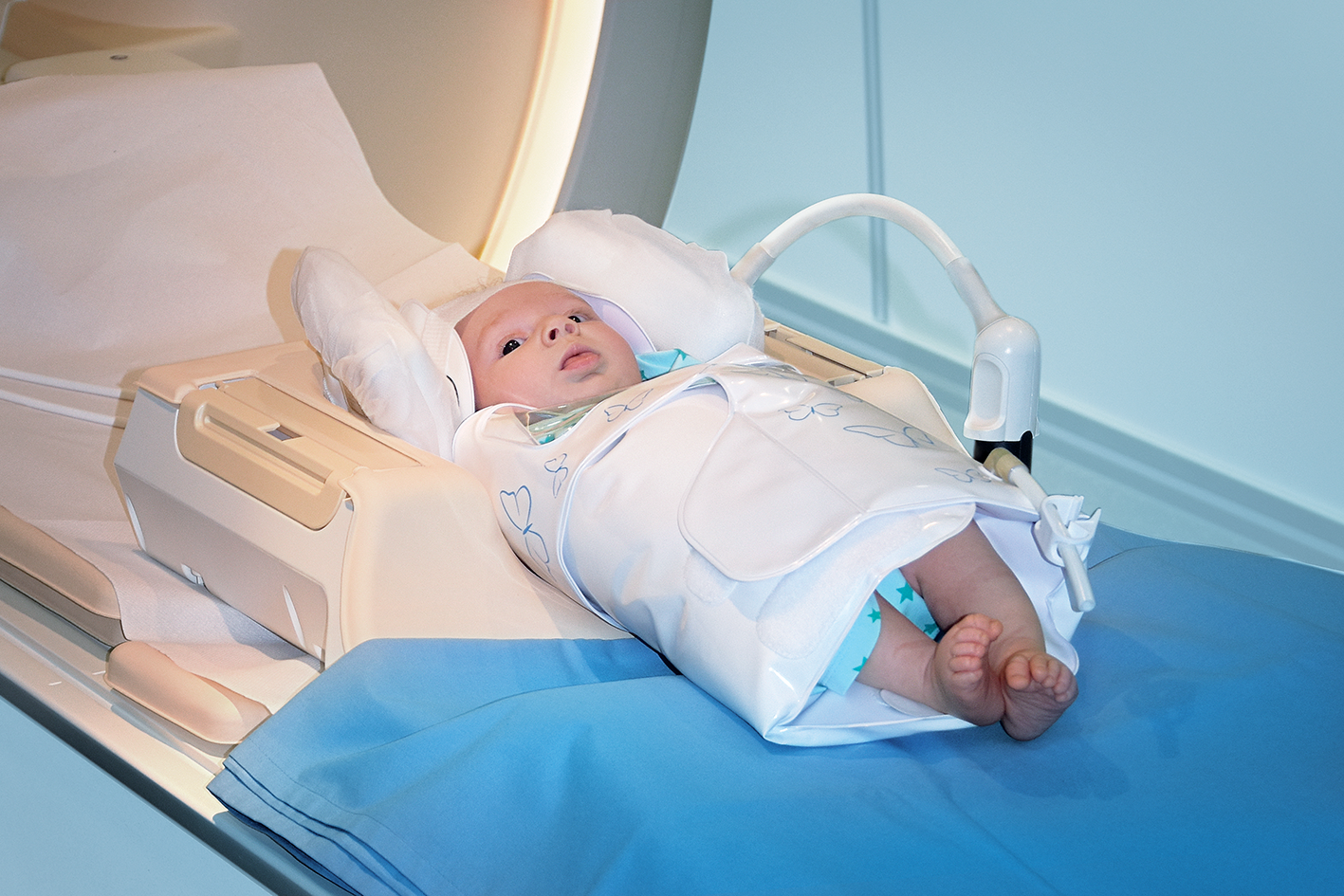 Neugeborenes liegt in MRT Spule in BabyFix Cocoon gewickelt