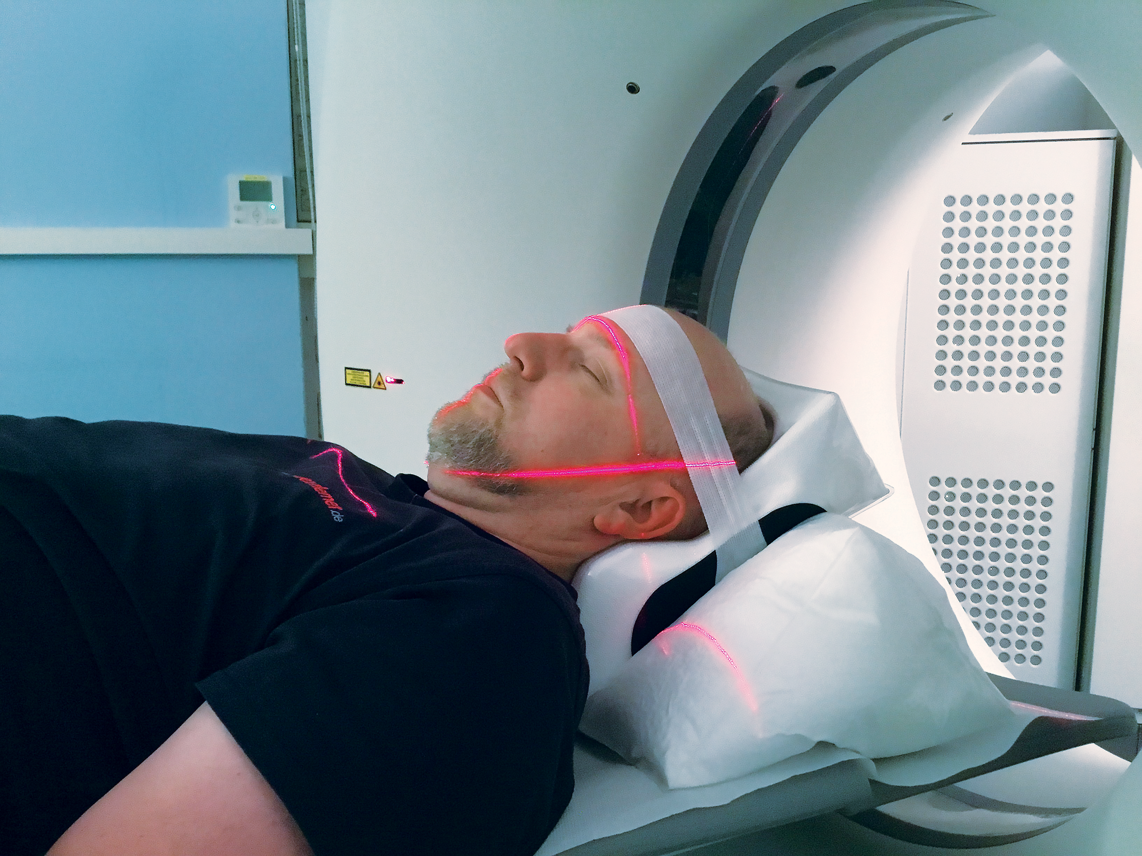 Head Fixation during CT Scan using PearlFit Head/Neck Vac