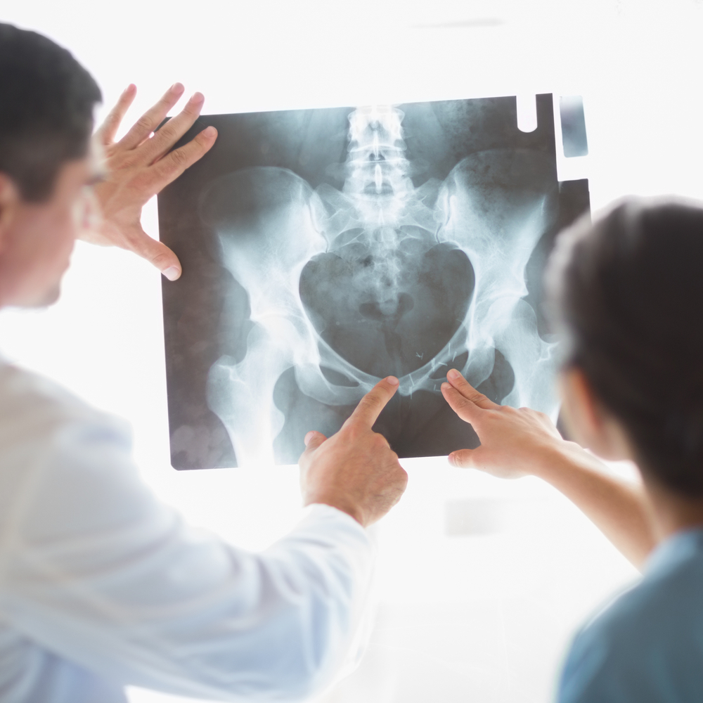 Ärzte diskutieren Röntgenaufnahme der Hüfte