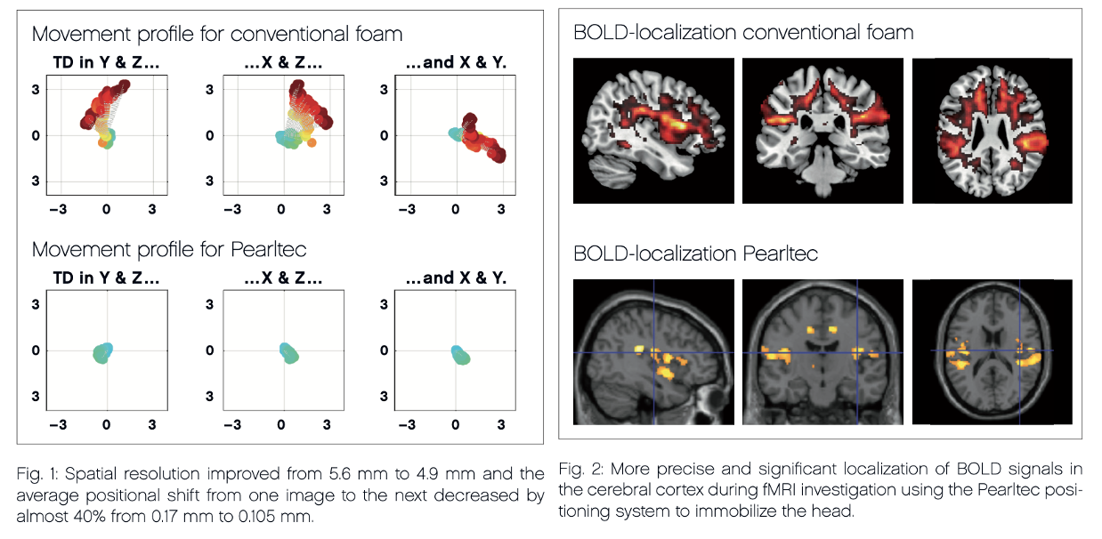 Comparison image quality using conventional foam vs. Crania positioning aid